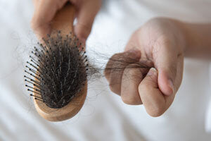 Hair Loss from Covid