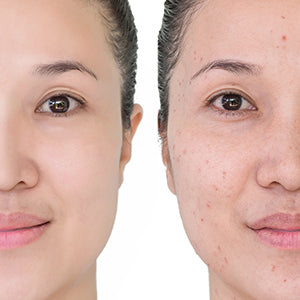Top 10 Safe Skin Lightening Ingredients