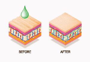 Retinol or Glycolic Acid?